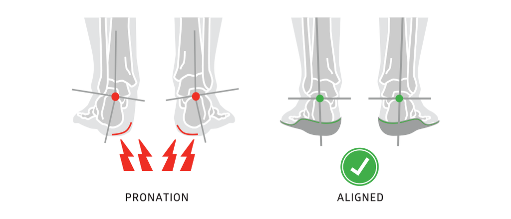 what is pronation overpronation supination, February 2020