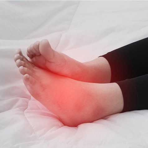 How to Prevent Swollen Feet and Legs from Prolonged Standing