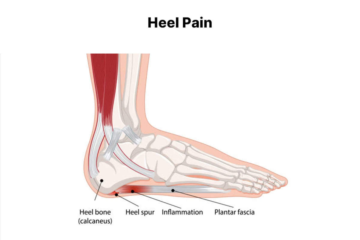 Comfortable men’s walking shoes for bunion pain